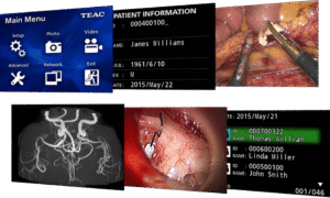 חשיבות הקלטת וידאו בזמן פרוצדורה רפואית