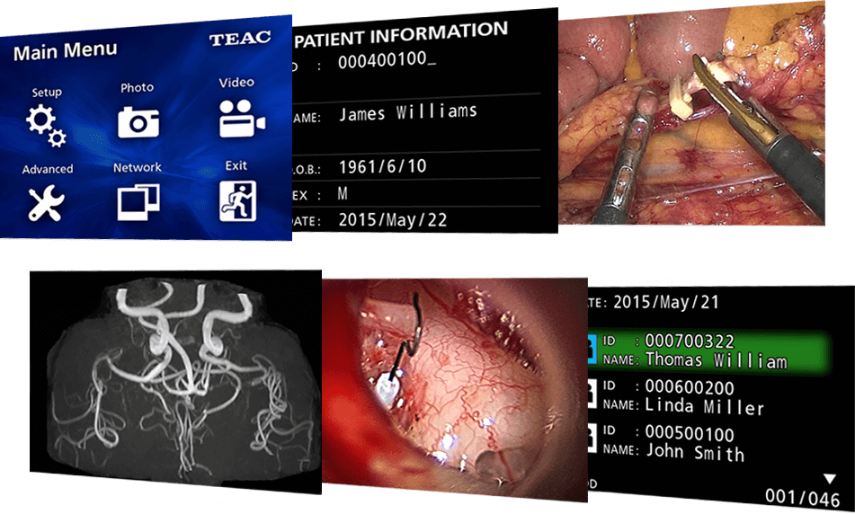 חשיבות הקלטת וידאו בזמן פרוצדורה רפואית